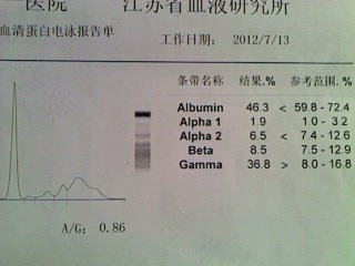 有子宫肌瘤血压会高吗 有子宫肌瘤血压会高吗