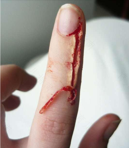 宝宝手上长倒刺是怎么回事 宝宝手上长倒刺是怎么回事