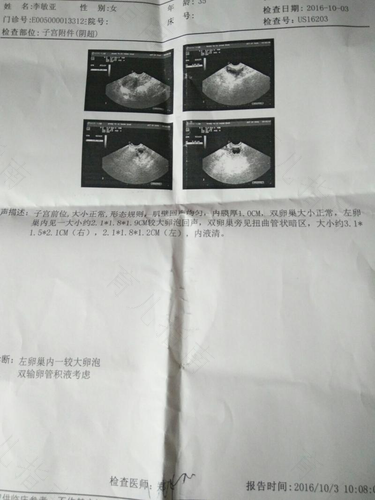 腹腔积液是什么原因? 腹腔积液是什么原因?