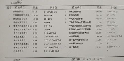 缺铁性贫血很严重怎么办 缺铁性贫血很严重怎么办