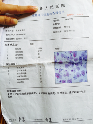 宫颈糜烂怎么复查的 宫颈糜烂怎么复查的