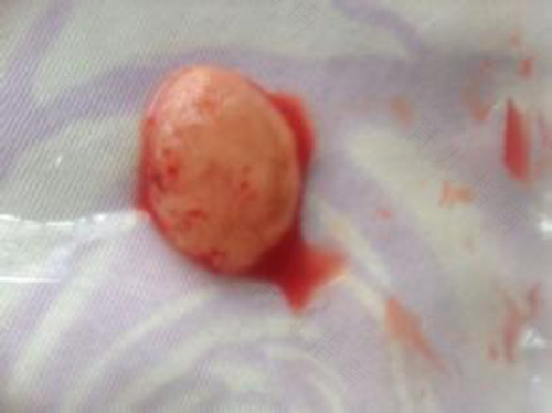 药流时间是多少天到多少天 药流时间是多少天到多少天