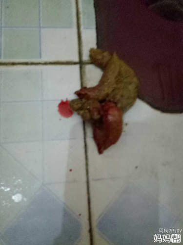 老人拉血便是怎么回事 老人拉血便是怎么回事