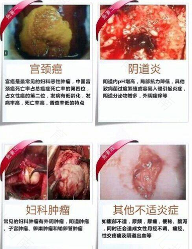 宫颈为什么没有痛感神经 宫颈为什么没有痛感神经