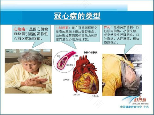 冠心病发作该怎么办 冠心病发作该怎么办