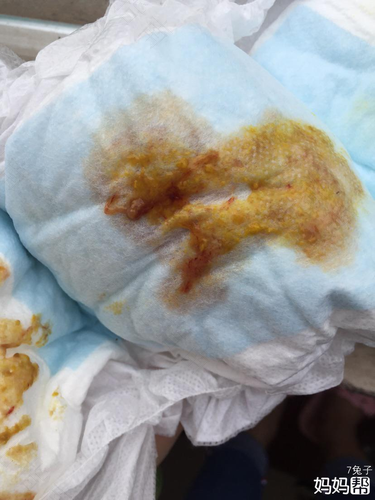 拉肚子会有血怎么回事 拉肚子会有血怎么回事