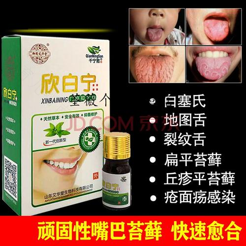 白口疮怎么治是什么原因导致的 白口疮怎么治是什么原因导致的