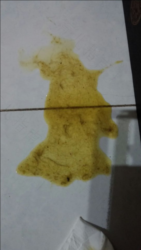 大半夜吐了怎么回事还拉稀 大半夜吐了怎么回事还拉稀