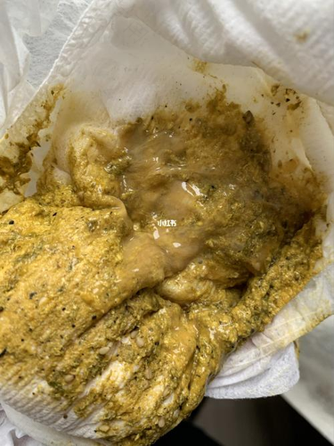 好几天不上大便怎么办