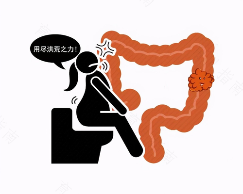 大便小腹疼痛怎么回事 大便小腹疼痛怎么回事