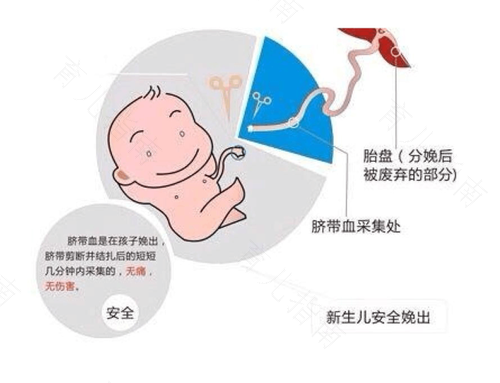 脐带血可以治自闭症吗? 脐带血可以治自闭症吗?
