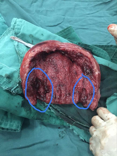 阴口红是怎么回事原因???