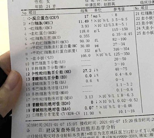 eb病毒感染指标