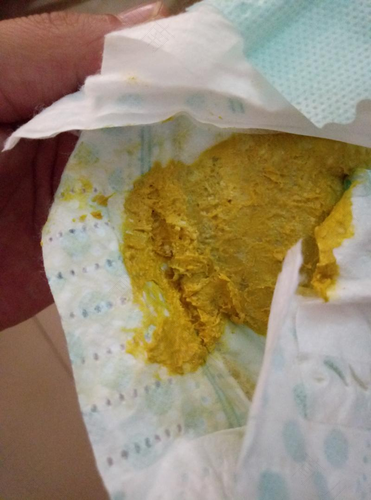 拉大便拉不出怎么办呢 拉大便拉不出怎么办呢