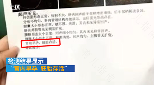 b超可以看出子宫穿孔吗 b超可以看出子宫穿孔吗