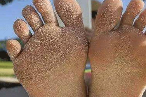 二型糖尿病初期症状有哪些 二型糖尿病初期症状有哪些