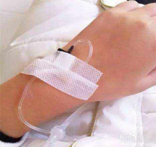 感冒打点滴要多久 感冒打点滴要多久