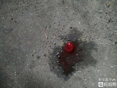 腰疼下面流血怎么回事女性 腰疼下面流血怎么回事女性