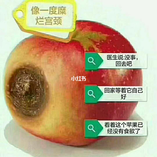 子宫糜烂是什么样的症状 子宫糜烂是什么样的症状