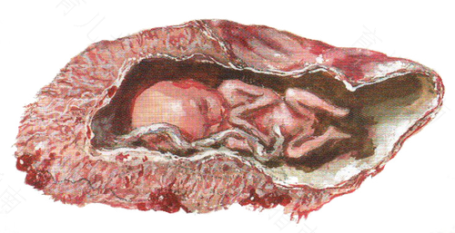 人流受凉了有什么症状 人流受凉了有什么症状