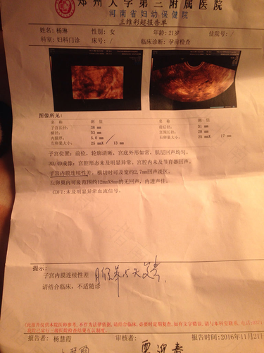 子宫内膜结节是什么病 子宫内膜结节是什么病