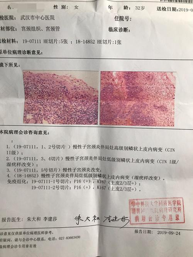 宫颈活检后多久能喝酒