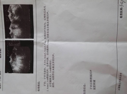 盆腔里有少量积液怎么办 盆腔里有少量积液怎么办