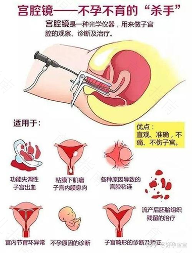 处女能得子宫内膜炎吗? 处女能得子宫内膜炎吗?
