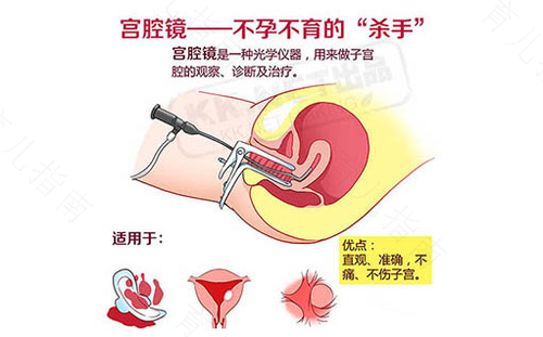 做宫腔镜疼还是刮宫疼 做宫腔镜疼还是刮宫疼