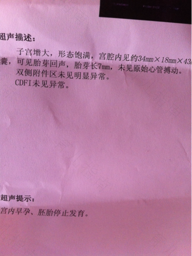 可见原始心管搏动是什么意思