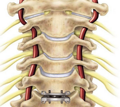 强直性脊柱炎是不是免疫力低下 强直性脊柱炎是不是免疫力低下