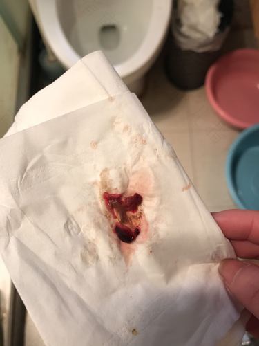 有痛人流很痛吗? 有痛人流很痛吗?