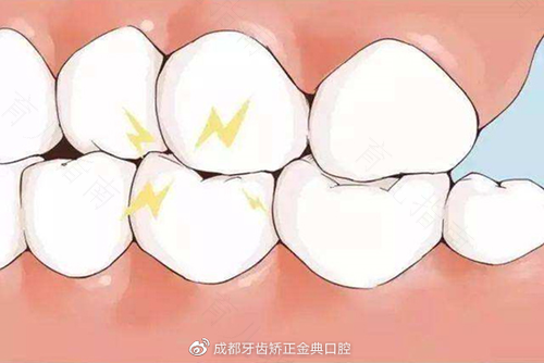 小孩子半夜磨牙是怎么回事