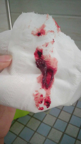 射精时右腹部疼痛是什么原因 射精时右腹部疼痛是什么原因