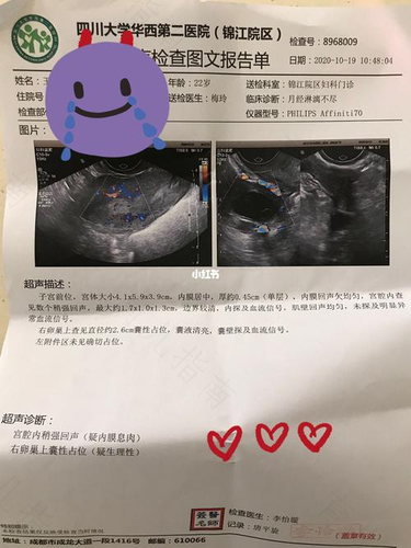 子宫内膜息肉严重吗? 子宫内膜息肉严重吗?