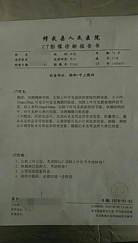 子宫内膜癌ca是几期 子宫内膜癌ca是几期
