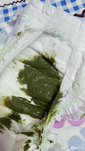 宝宝拉稀绿色的是怎么回事 宝宝拉稀绿色的是怎么回事