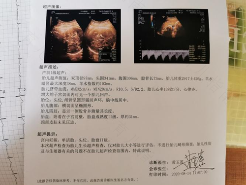 孕9月分娩开始进入倒计时
