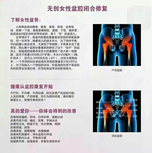 骨盆修复一般做几次有效果 骨盆修复一般做几次有效果