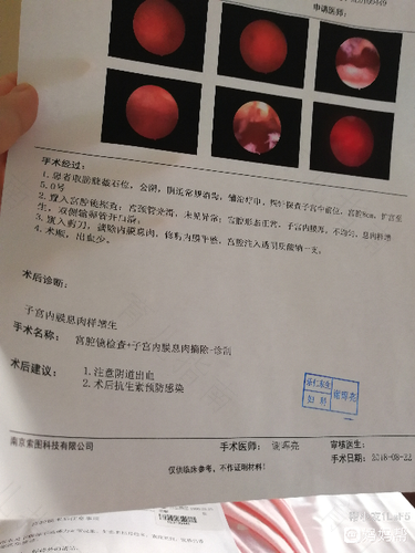 子宫内膜增厚需要做手术吗 子宫内膜增厚需要做手术吗