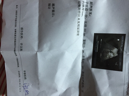 子宫内膜厚度怎样检查 子宫内膜厚度怎样检查