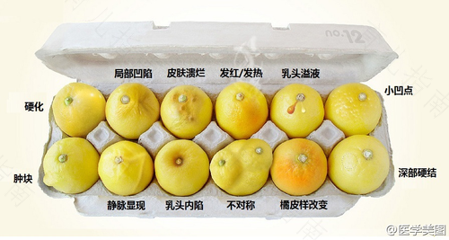 乳腺恶性早期怎么治疗