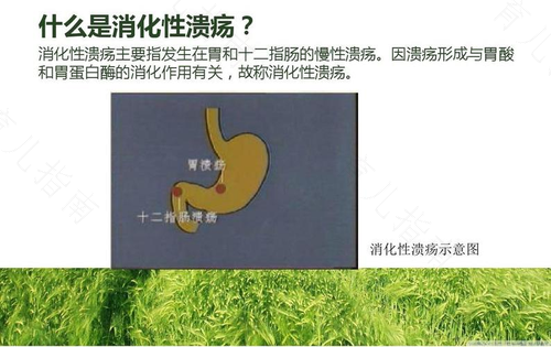 非溃疡性消化不良 非溃疡性消化不良