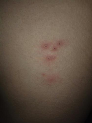 头皮全身都痒怎么回事 头皮全身都痒怎么回事