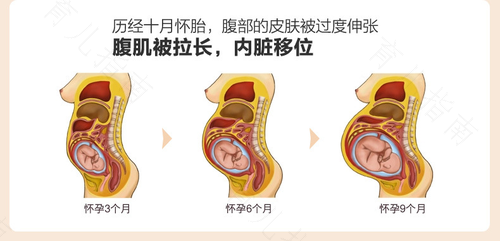 子宫壁薄可以手术修复吗