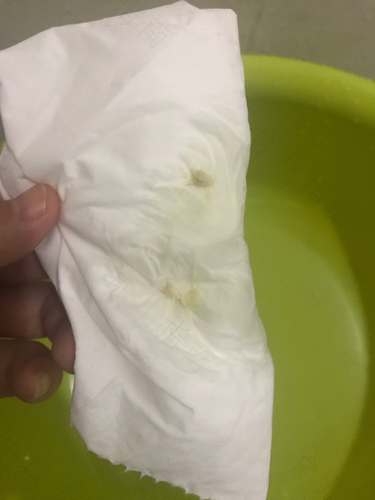 乳白色粘稠浆糊状白带