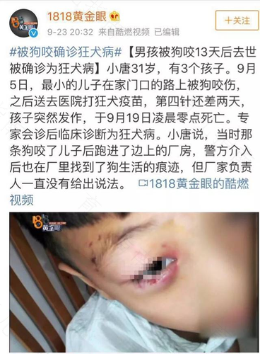 恐惧狂犬病怎么办 恐惧狂犬病怎么办