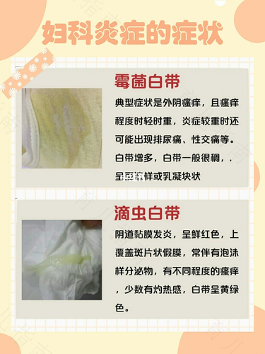 宫颈炎有褐色分泌物严重吗 宫颈炎有褐色分泌物严重吗