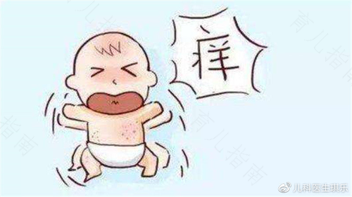 小孩得寻麻疹会传染给大人吗