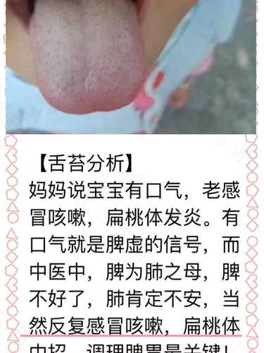 小孩感冒咳嗽有口臭是怎么回事 小孩感冒咳嗽有口臭是怎么回事